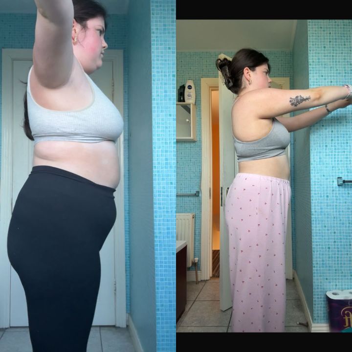 Mairead before and after losing 8kg
